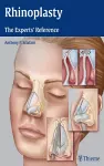 Rhinoplasty cover