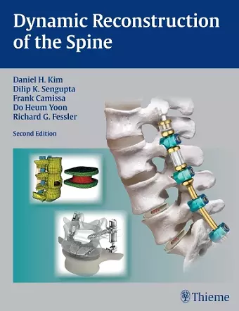 Dynamic Reconstruction of the Spine cover