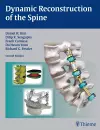 Dynamic Reconstruction of the Spine cover