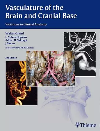 Vasculature of the Brain and Cranial Base cover