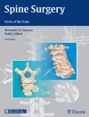 Spine Surgery cover