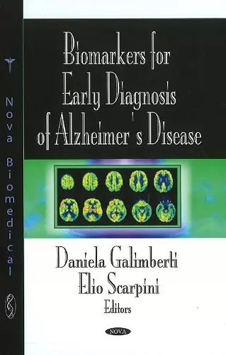 Biomarkers for Early Diagnosis of Alzheimer's Disease cover