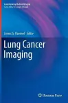 Lung Cancer Imaging cover