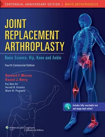 Joint Replacement Arthroplasty cover