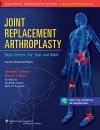 Joint Replacement Arthroplasty cover