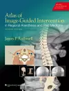 Atlas of Image-Guided Intervention in Regional Anesthesia and Pain Medicine cover