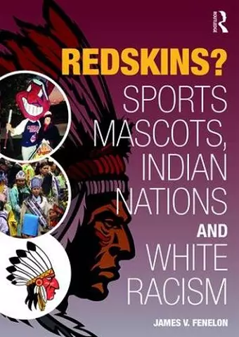 Redskins? cover