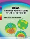 Atlas and Clinical Reference Guide for Corneal Topography cover