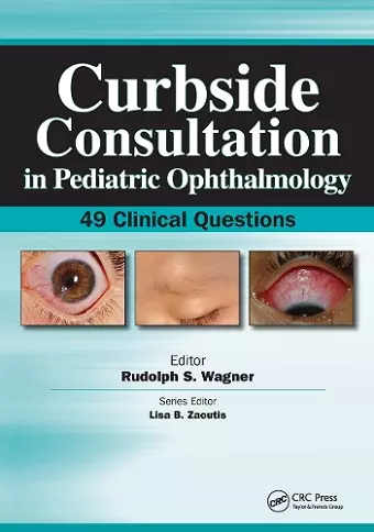 Curbside Consultation in Pediatric Ophthalmology cover