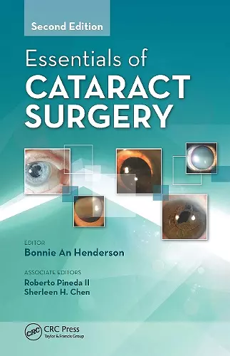 Essentials of Cataract Surgery cover