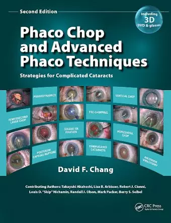 Phaco Chop and Advanced Phaco Techniques cover