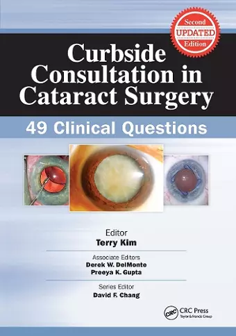 Curbside Consultation in Cataract Surgery cover