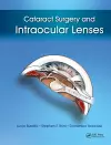 Cataract Surgery and Intraocular Lenses cover