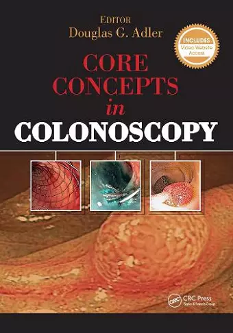 Core Concepts in Colonoscopy cover