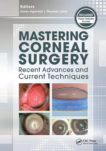 Mastering Corneal Surgery cover