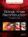 Biologic Knee Reconstruction cover