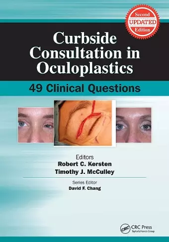 Curbside Consultation in Oculoplastics cover