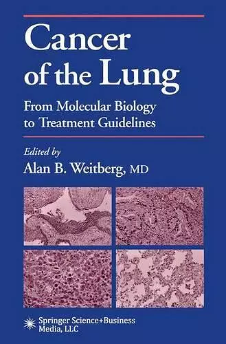 Cancer of the Lung cover