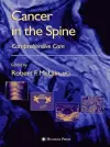 Cancer in the Spine cover