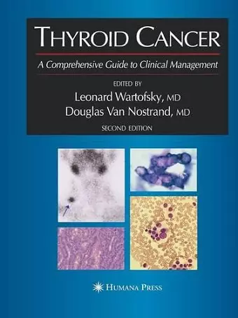 Thyroid Cancer cover