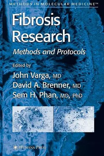 Fibrosis Research cover