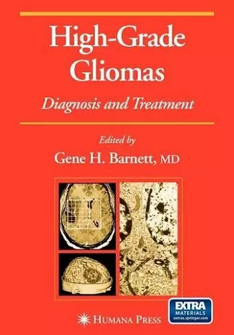 High-Grade Gliomas cover