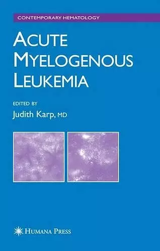 Acute Myelogenous Leukemia cover