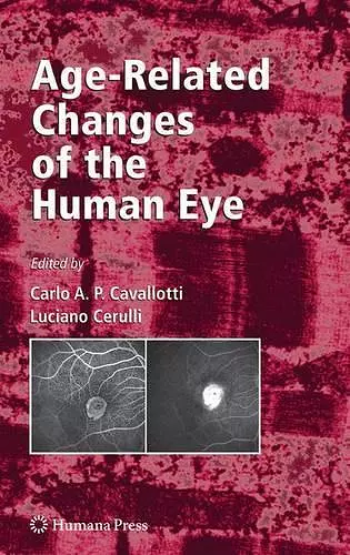 Age-Related Changes of the Human Eye cover