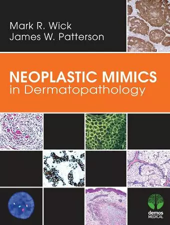 Neoplastic Mimics in Dermatopathology cover