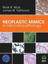 Neoplastic Mimics in Dermatopathology cover