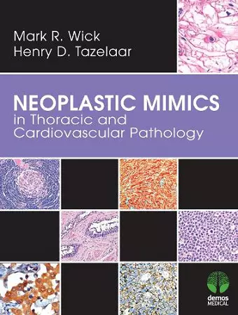 Neoplastic Mimics in Thoracic and Cardiovascular Pathology cover