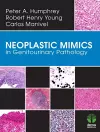 Neoplastic Mimics in Genitourinary Pathology cover