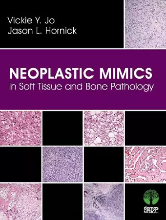 Neoplastic Mimics in Soft Tissue and Bone Pathology cover