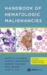 Handbook of Hematologic Malignancies cover