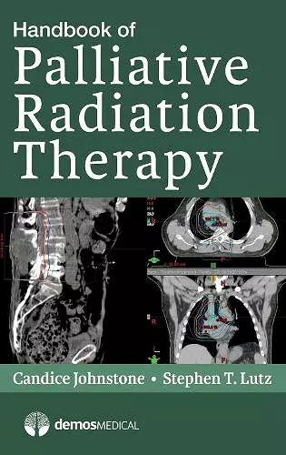 Handbook of Palliative Radiation Therapy cover