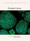 Prostate Cancer cover