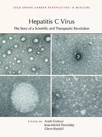 Hepatitis C Virus cover