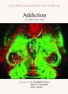 Addiction, Second Edition cover