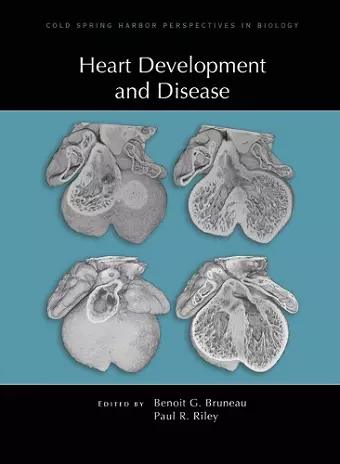 Heart Development and Disease cover