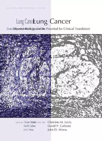 Lung Cancer cover