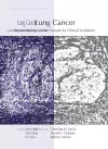 Lung Cancer cover
