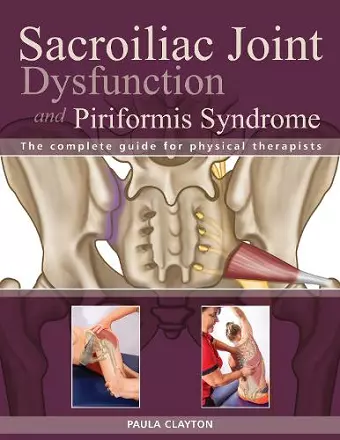 Sacroiliac Joint Dysfunction and Piriformis Syndrome cover