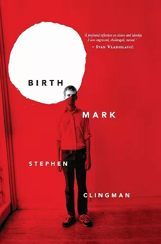 Birthmark cover