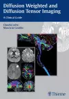 Diffusion Weighted and Diffusion Tensor Imaging cover