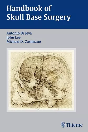 Handbook of Skull Base Surgery cover