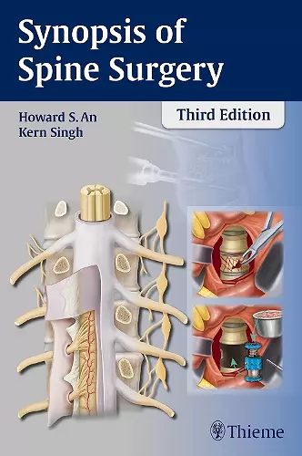 Synopsis of Spine Surgery cover