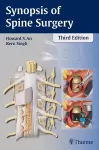 Synopsis of Spine Surgery cover