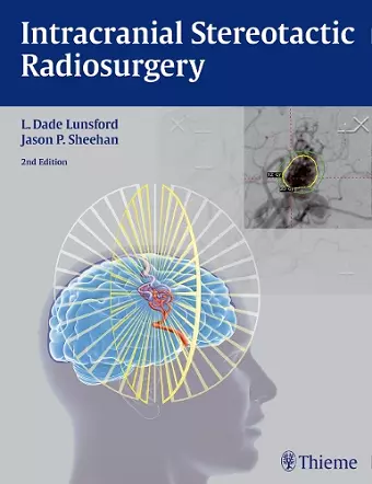 Intracranial Stereotactic Radiosurgery cover