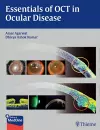 Essentials of OCT in Ocular Disease cover