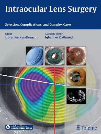 Intraocular Lens Surgery cover